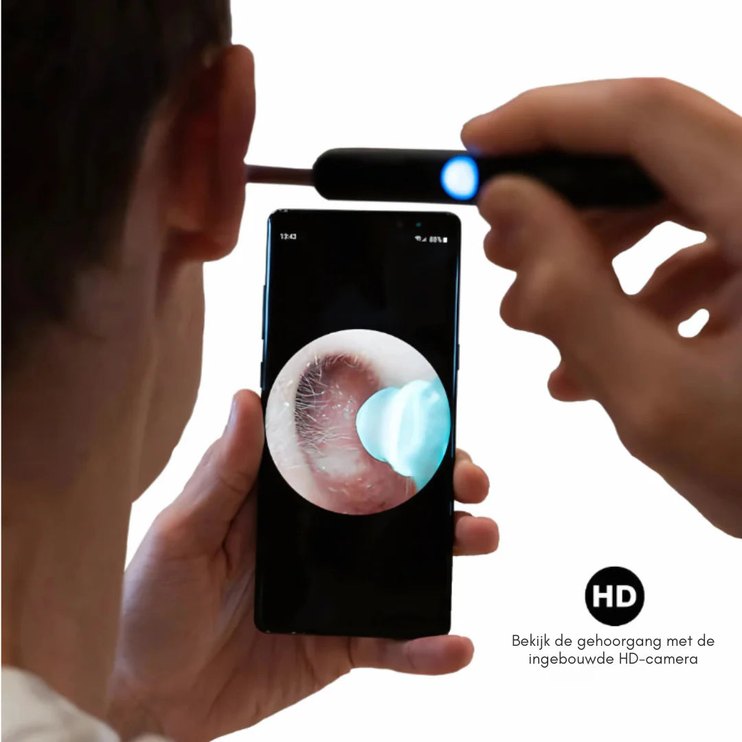 WaxView PRO | Slimme Oorreiniging Met HD Camera