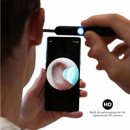 WaxView PRO | Slimme Oorreiniging Met HD Camera