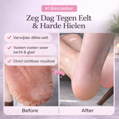 DermaVoet™ Eeltwisser Pro