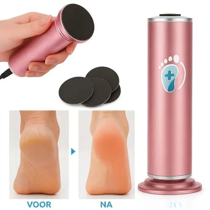 DermaVoet™ Eeltwisser Pro